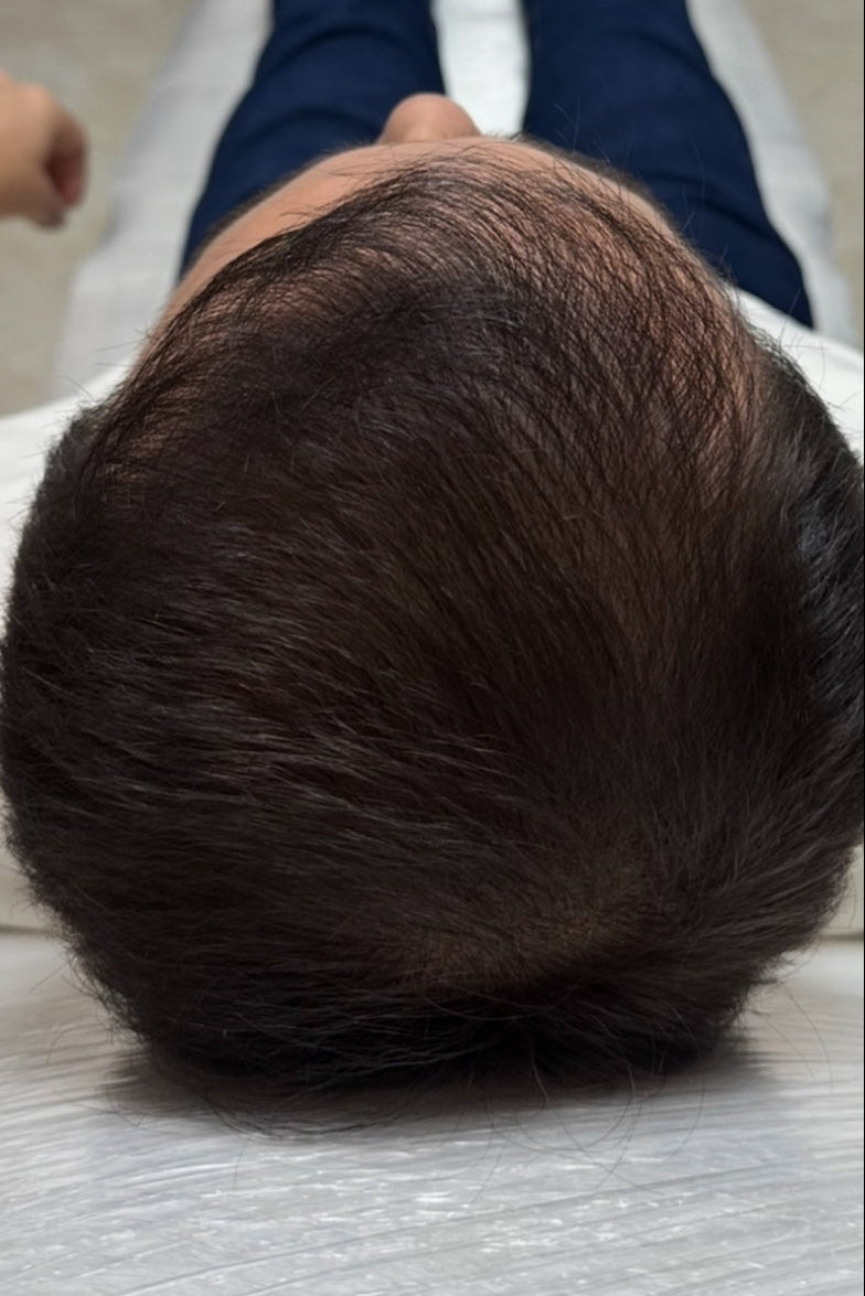 Resultado después del tratamiento